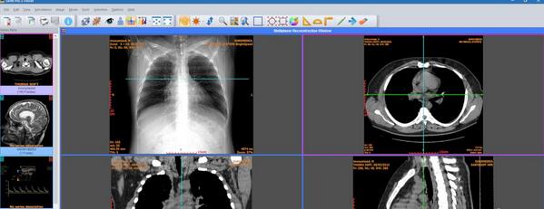 Sante PACS Server screenshot