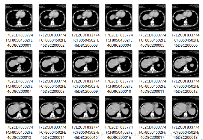 MicroDicom screenshot