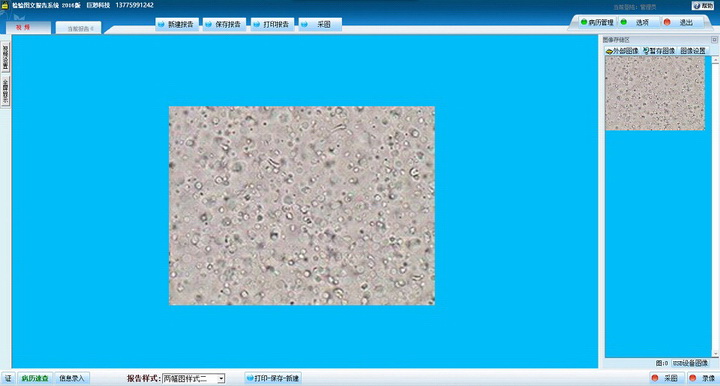 Jumiao inspection graphic report reporting system