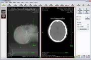 Ruiying medical imaging PACS workstation system