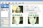 Feiteng skin texture testing system