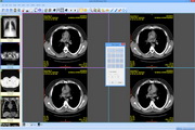 Sante DICOM Viewer FREE