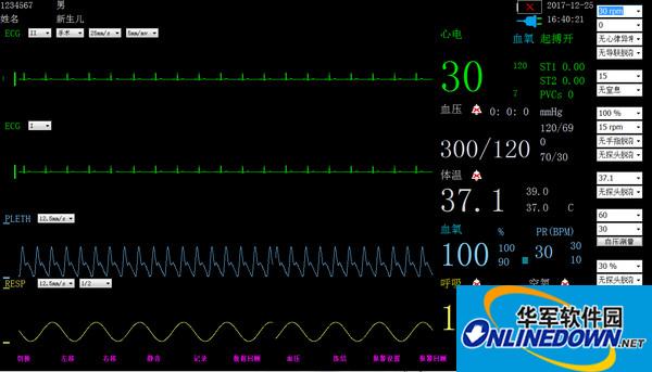 Neonatal monitor software Verbpo