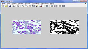 Image segmentation topic