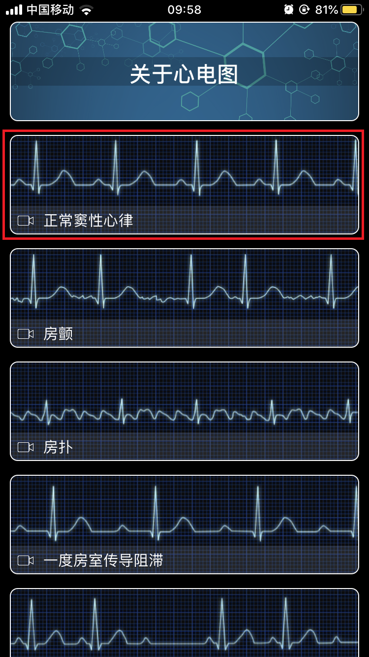 Electrocardiography