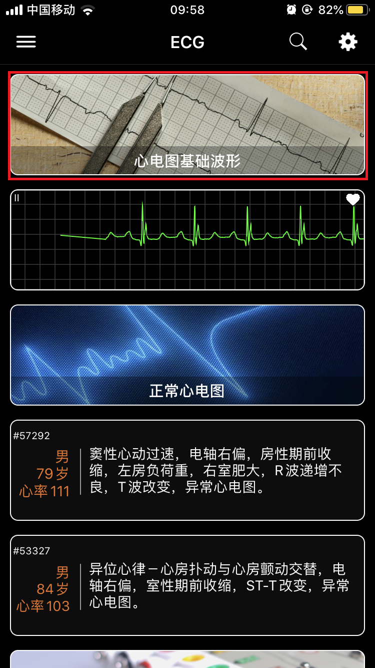 Electrocardiography