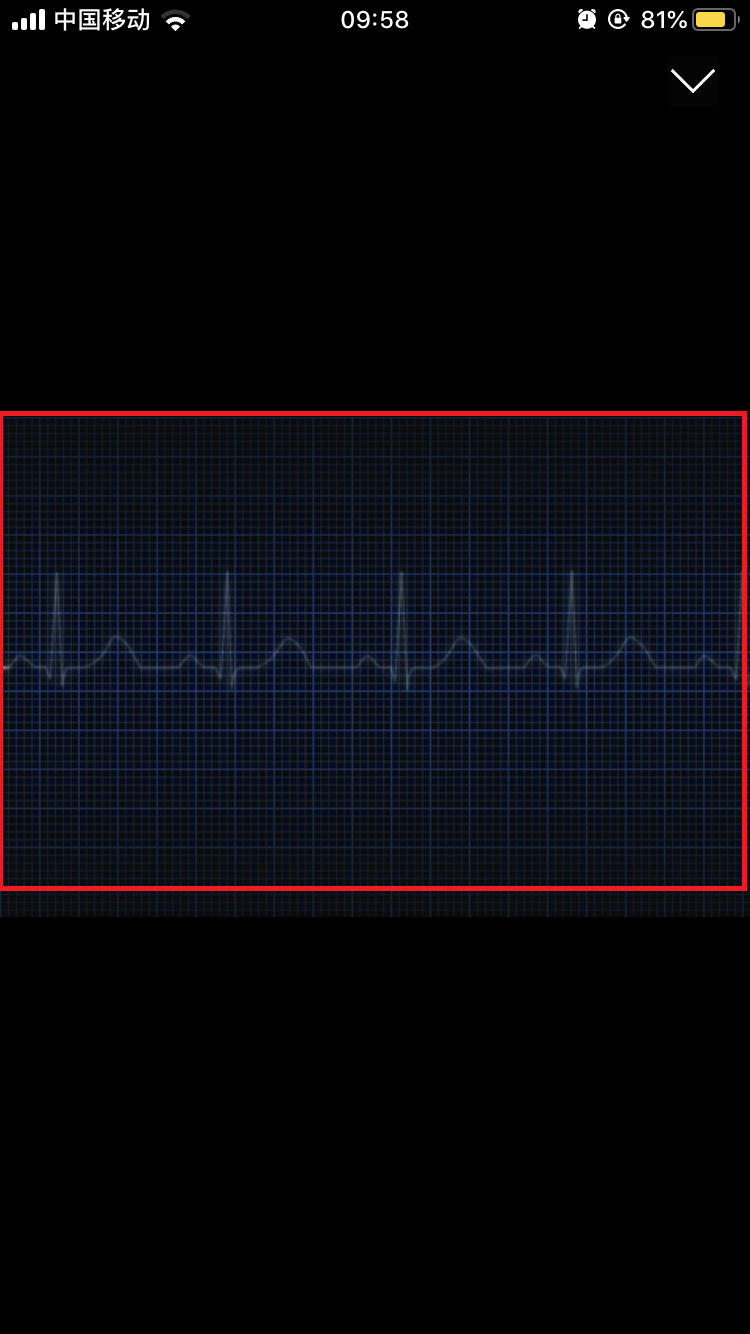 Electrocardiography